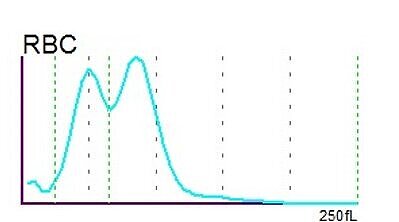 RBC histogram