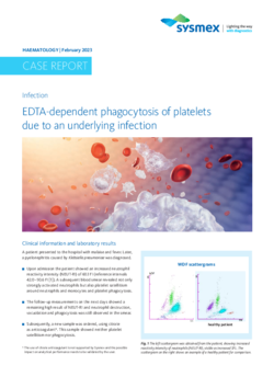 EDTA-dependent phagocytosis of platelets due to an underlying infection