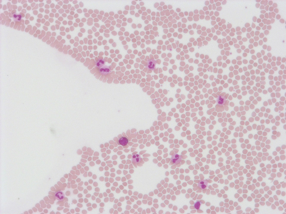 Edge of blood film Edge of blood film